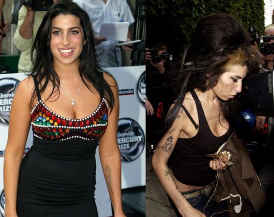 Amy Whinehouse Before amp; After