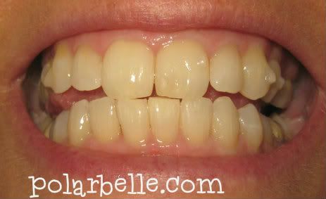 smile brilliant
